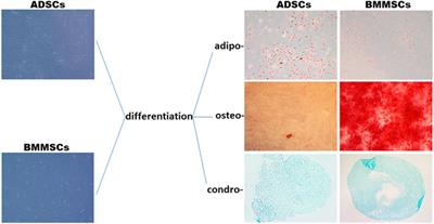 Stem cell‐derived extracellular vesicles reduce the expression of molecules involved in cardiac hypertrophy—In a model of human-induced pluripotent stem cell-derived cardiomyocytes